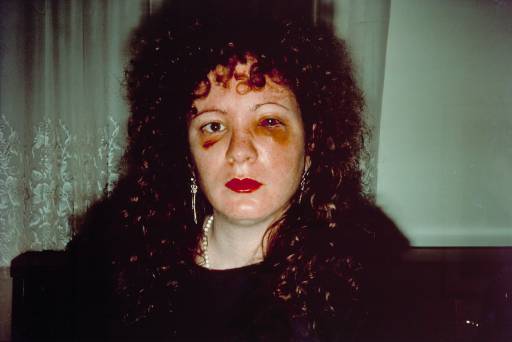 nan-goldin-nan-one-month-after-being-battered nan-goldin-nan-one-month-after-being-battered