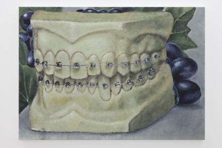 Issy Wood, Slouching towards the maxillofacial unit (2018), via JTT